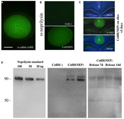 Intranasal Delivery of Collagen-Loaded Neprilysin Clears Beta-Amyloid Plaques in a Transgenic Alzheimer Mouse Model